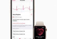 The Apple Watch Might Soon Be Facing An International Import Ban