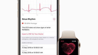 The Apple Watch Might Soon Be Facing An International Import Ban
